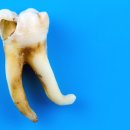 은행사거리 이미지