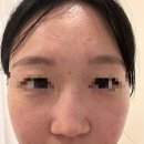 한솔 | 전주 만성동 에스테틱 추천 스튜디오 한솔 문제성 피부관리 후기