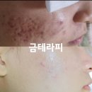 테라피 뷰티샵 네이버블로그