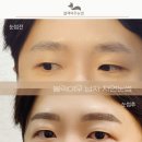 여우눈썹 티스토리