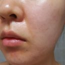 닥터퓨어민 | 닥터브로너스 티트리 퓨어 캐스틸 솝 후기, 뽀득뽀득 잘 씻기고 등드름에 굳굳!