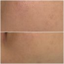 인제한의원 | 제주 인제 물광 트러블 장벽 케어 리프팅 피부관리 추천, 결 에스테틱 로제필