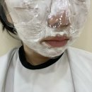 송도피부과 밴스의원 송도점 스킨부스터 포텐자콜라스터후기