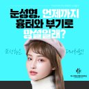 더나처럼성형외과