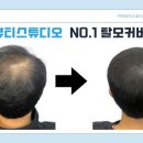 에이비씨코
