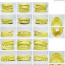 바른치과기공소 이미지