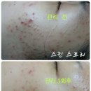스킨스토리 네이버블로그