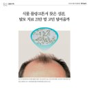 루비인셀덤