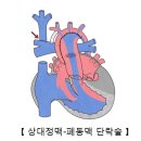 단실 이미지