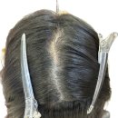 원스칼프 이미지