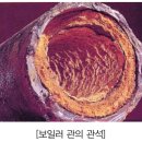 관석 네이버블로그