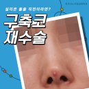 최우식노즈립성형외과의원 이미지