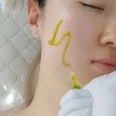 여주 문제성 피부관리 메디스킨 유리하