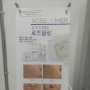 연신내피부관리 [내일의 피부] 알라딘필 후기, 은평구 여드름 피부관리