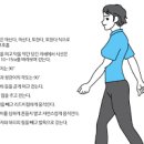 하지정맥류 초기 방법 운동 이미지