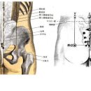 엉덩이의 통증 (질변혈 ) 이미지