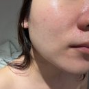 11305-18-308-10 | [천안] 피부 고민이 있다면? 피부과보단, ♥비스킨랩 천안본점♥ (feat. 피부 자존감 연구소)