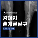 상무병원 | 상무지구 동물병원 강아지 슬개골탈구 3기 수술 후기 활차구성형술