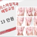 스마일치과 이미지