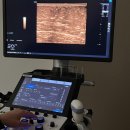 공주사 | 허벅지 지방분해주사 가격 및 효과로 알아보는 단기 다이어트 시작 1회차 후기