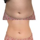 중앙미생물연구소 캐치콜 라이트 15시간만에 -1.3kg 체지방감소 다이어트보조제 솔직후기