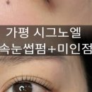 시그노엘 네이버블로그