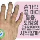 손가락 마디 통증 위치에 따라 달라요 이미지