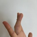 유대현나경선내과의원 | 갑자기 새벽에 손가락 관절 부음, 재발성류마티즘?