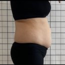 다이어핏 | 동탄다이어트트 찾다가 정착한 에소코핏 라크몽 솔직 후기