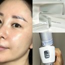 한국메디컬솔루션즈(주) | 피부케어를 위한 뷰티디바이스 추천 리센스메디컬 쿨로아600