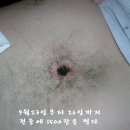 전중 Daum카페