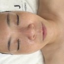 에이치타워206 | [안양평촌피부관리] 모공 고민 끝! 에스떼제이 '피부를리셋하다'로 다음날 광채 폭발한 찐후기