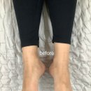 끌림 재활PT&필라테스 | 선릉 체형교정&amp;PT전문 포그로스 재활 필라테스 후기