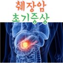 꼭 알아두세요! 췌장암 초기 증상 이미지