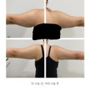 지힐링스퀘어의원 | [공지] 지힐링스퀘어의원 불만족 후기 사진 -지팻주사