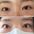 [동탄 속눈썹펌] 윤슬뷰티스튜디오 :: 속눈썹펌 찐만족 후기