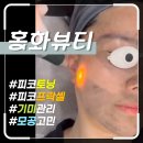대구에스테틱 홍화뷰티 기미관리 피코토닝 피코프락셀 후기