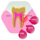 잇몸이 나빠지면 생길 수 있는 각종 질환 이미지