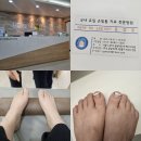 내일의원 | 내성발톱 교정기시술 후기(내돈내산, 실비처리, 비용) :: 잠실 내일의원