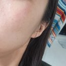 연세리앤피부과의원 이미지