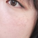 (주)더블에이트게임즈 | 기미 화장품 추천 얼굴 기미 매스티나 3시간 앰플로 관리