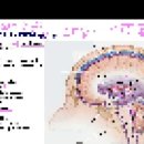 3/9(화) [1-3] (신경해부학강의) Meninges Ventricular system 2부 이미지