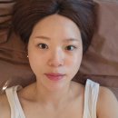 올가드림뷰티 성남 분당 푸른마을수내점 드림관리 &amp; 피부과 흑자 제거후기(한달 경과)