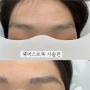 5129 | 편안한 시술을 받을 수 있는곳 정부청사역 대전눈썹 페이스터치