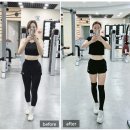 라인6차 | 상무지구피부과 종아리지방분해주사 6차후기 효과