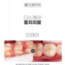금이랑은이랑 이미지