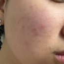 에스앤케어 이미지