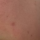 애프터메디 이미지