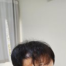 모모즈헤어&증모 이미지