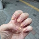 위티네일 이미지